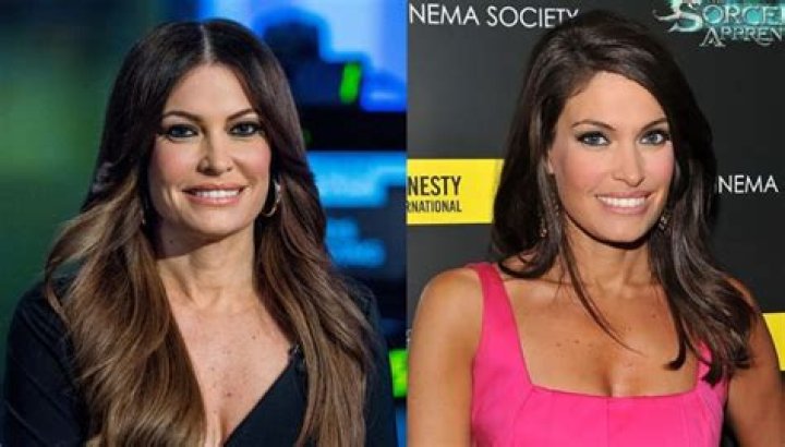 Transformations Unveiled: Kimberly Guilfoyle Before And After Images