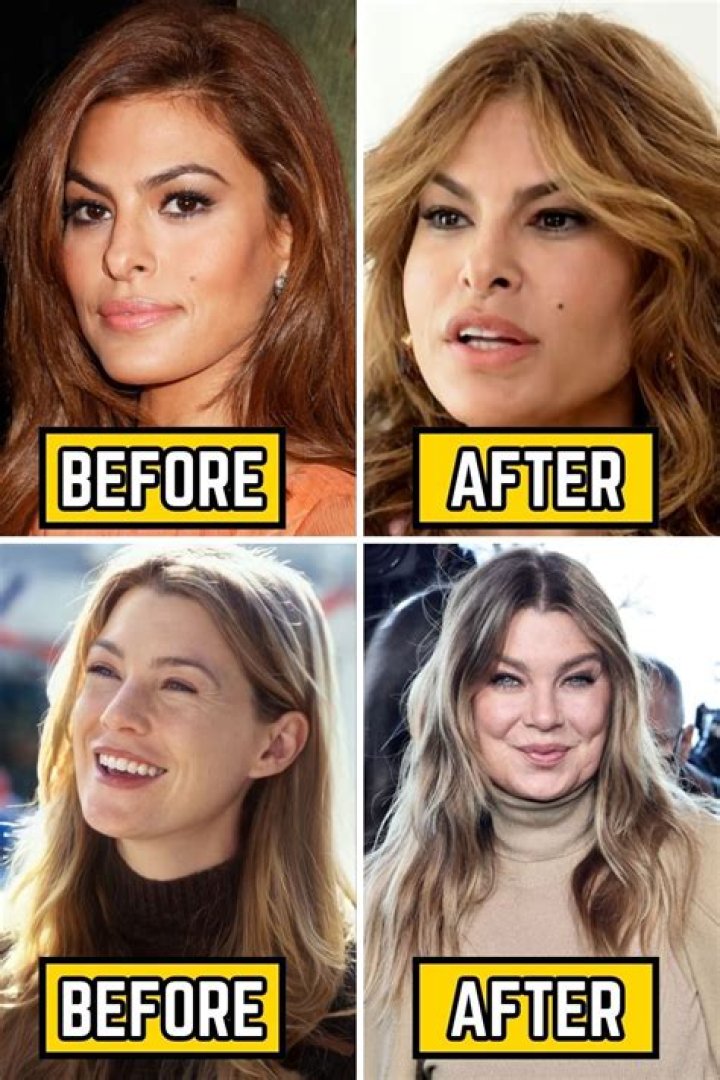 Transformations Unveiled: Kimberly Guilfoyle Before And After Plastic Surgery