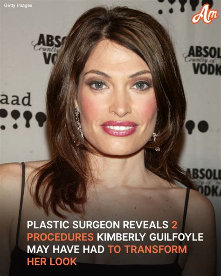 Understanding Kimberly Guilfoyle Before Surgery: A Journey Of Transformation