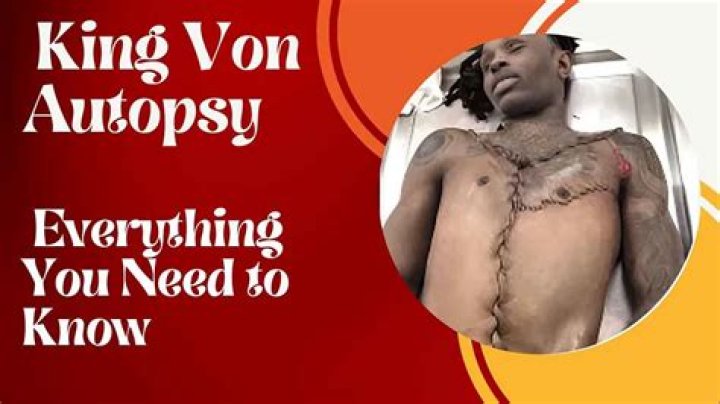 Unraveling The Mystery: King Von Autopsy Results