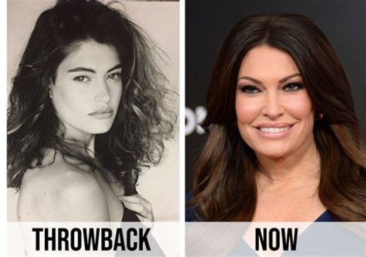 Unveiling The Transformation: Kimberly Guifoyle's Journey Through Plastic Surgery