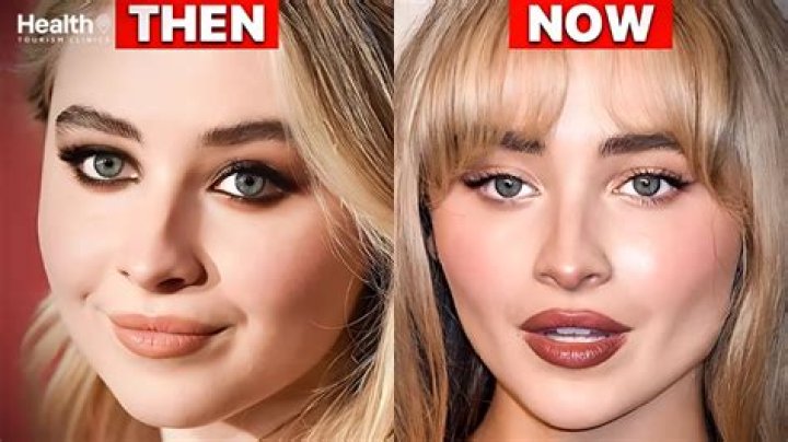 Unveiling The Truth Behind Sabrina Carpenter's Facial Surgery